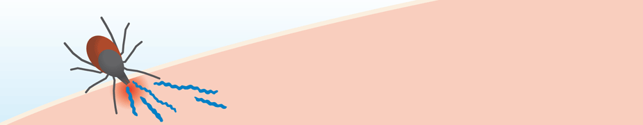 piq&ucirc;re de tique